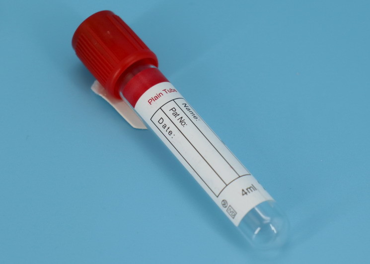 EDTA Vacuum Blood Collection Tube  No Additive  Blood Test Vacuum Tubes